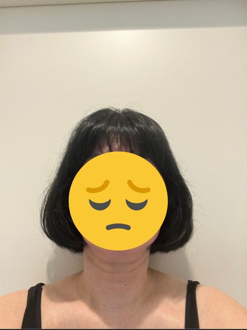 カット前の正面写真