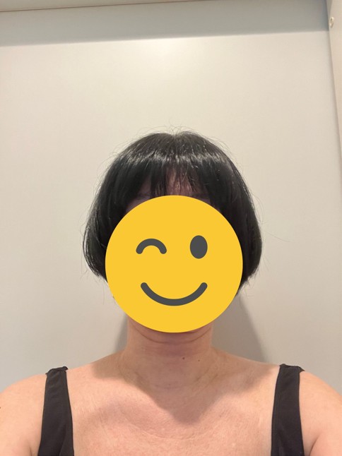 １回目カット後の正面写真