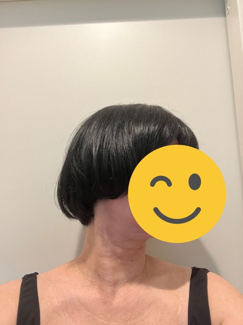 １回目カット後の側面写真