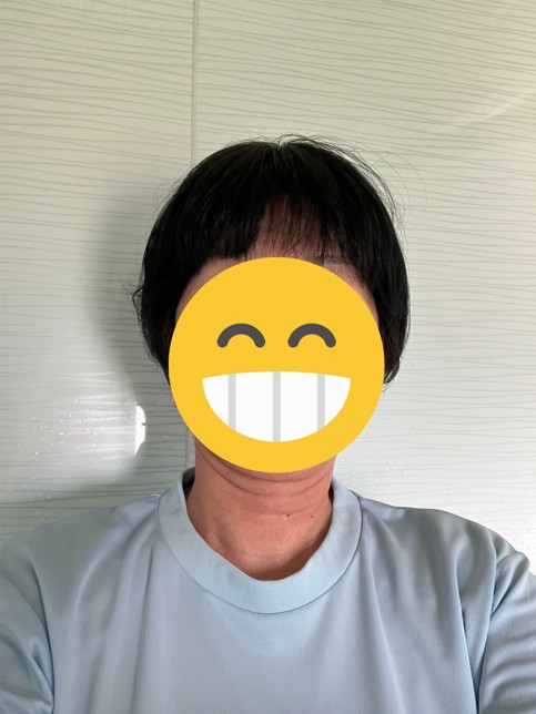 ２回目カット後の正面写真