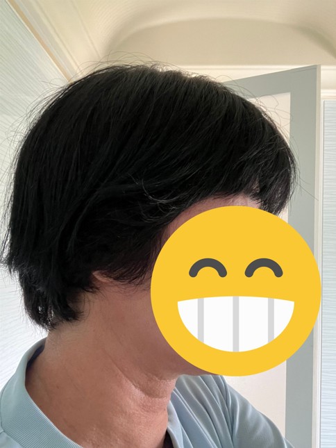 ２回目カット後の側面写真
