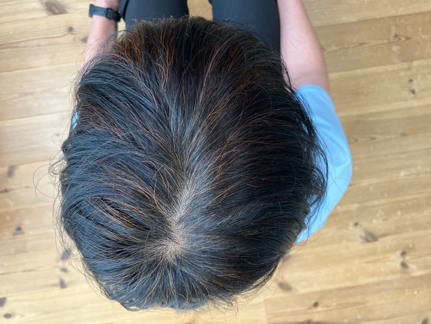 ヘナ染め3か月後の頭頂部の写真(自然光(室内))