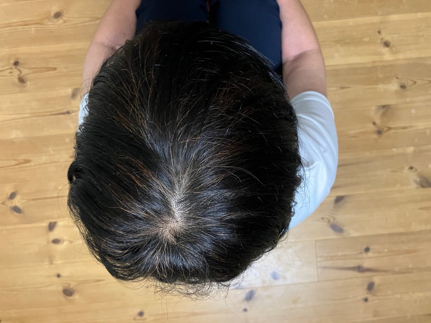 ヘナ染め3か月後の頭頂部の写真(照明(昼白色))