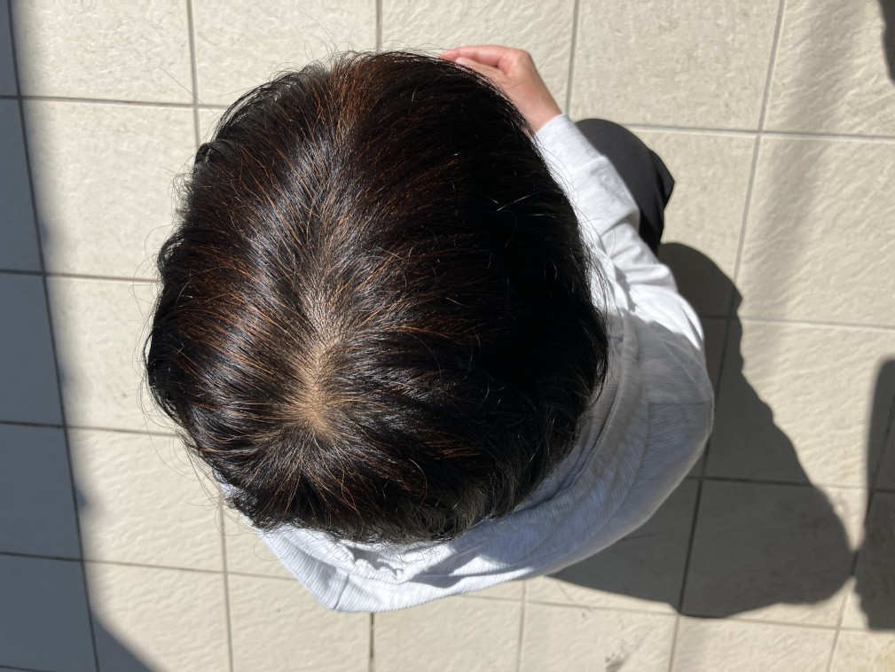 ヘナ染め3か月後の頭頂部の写真(自然光(屋外))